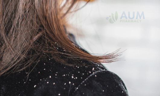 Dandruff