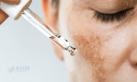 Hyperpigmentation