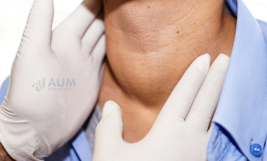 Hyperthyroidism