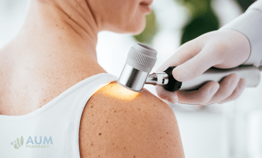 Melanoma