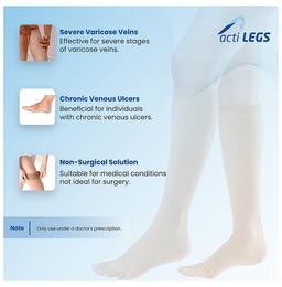 actiLEGS Class III Medical Compression Stocking Open Toe Knee Length XXL Skin Colour
