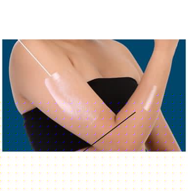 Surgiwear GDOT15 Own Tone G Dress Transparent (Without Pad)