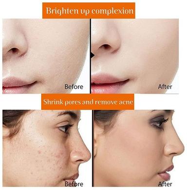 Aravi Organic Vitamin C 20% Face Serum Serum