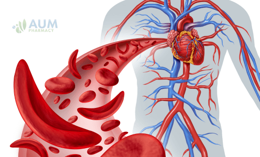 Sickle cell anemia
